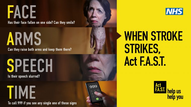When Stroke Strike, Act F.A.S.T.